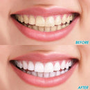 😁 Escova de Limpeza para Manchas nos Dentes – Sorriso Mais Brilhante em Minutos!