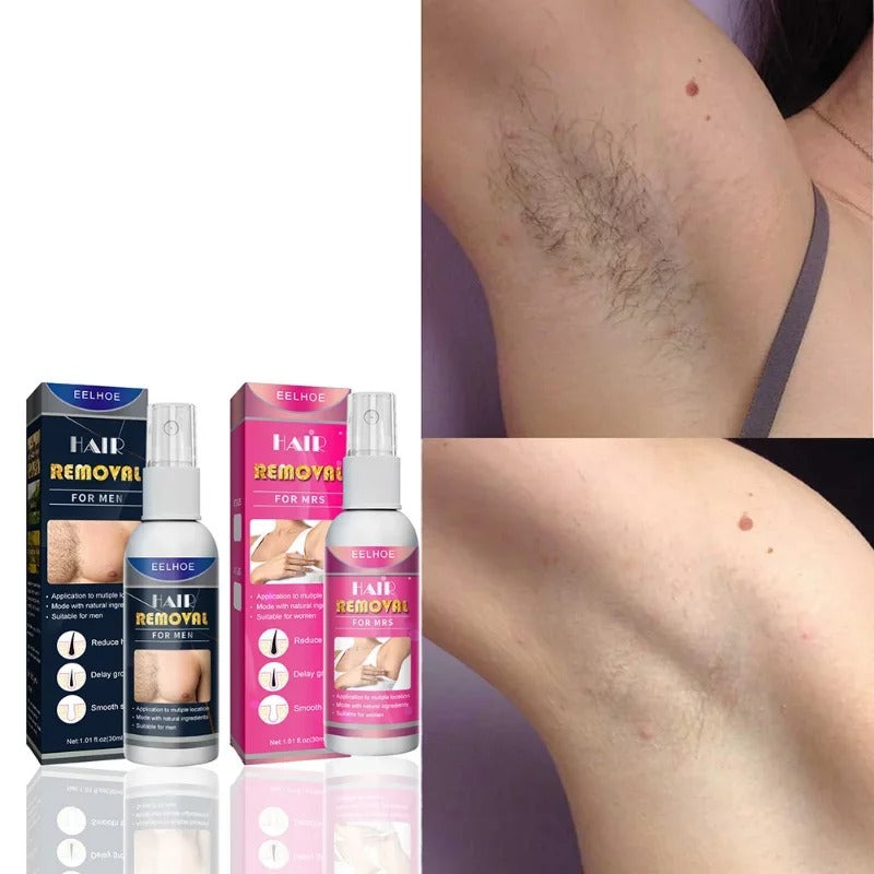 Spray Depilatório Corporal – Pele Lisa, Sem Esforço ✨