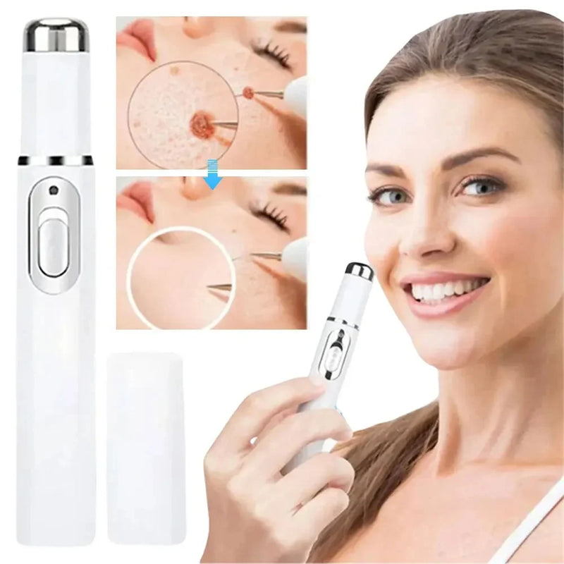 ⭐ Caneta Laser de Grau Médico – Remoção Precisa de Sinais, Verrugas e Manchas